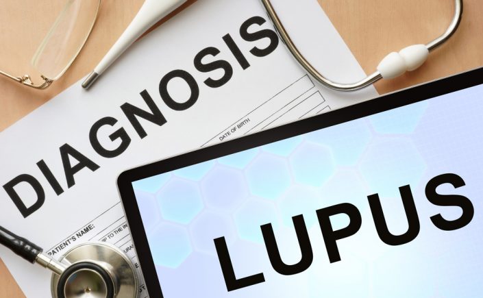 Sel DNA Dapat Membantu Menentukan Aktivitas Lupus